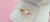 The Timeless Elegance of South Sea Pearl Rings
